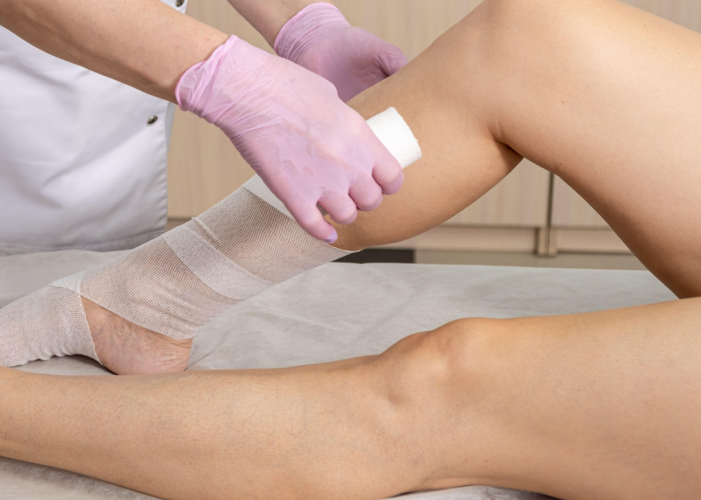 Doctora realizando un vendaje a un paciente que sufre un linfedema